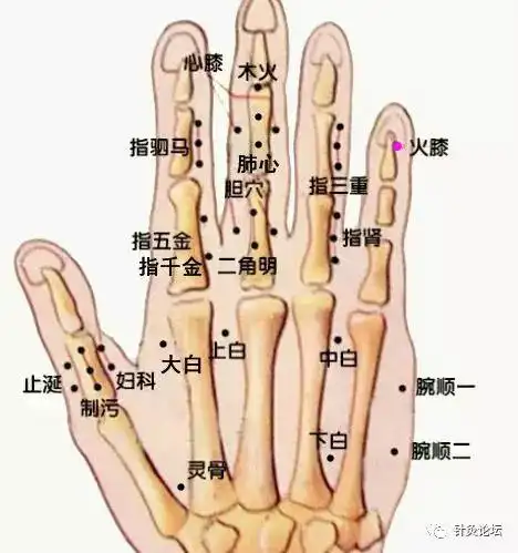 部位在小指甲外侧角后二分.针刺法五分针,针一分至二分.