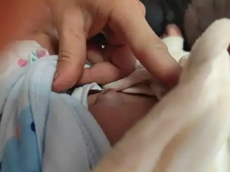 男宝宝疝气的症状图片52