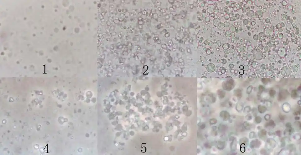 前列腺液显微图像实用精液细胞学