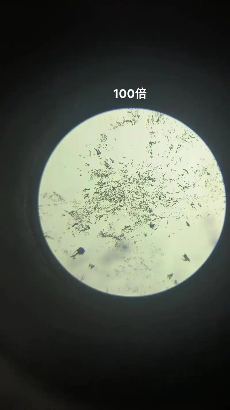显微镜观察霉菌孢子,大家猜一下这是哪种霉菌的孢子.#显微镜  - 抖音