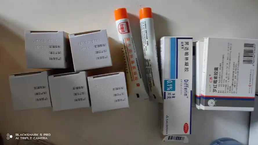 告别痘痘肌肤皮肤是好几年前,那时在杭州,因为一次过敏,长了很多痘