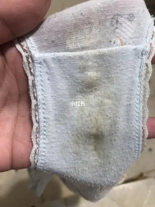 谁有跟我一样每天换一次内裤都这么脏,还湿哒哒的特不舒服,还有一股
