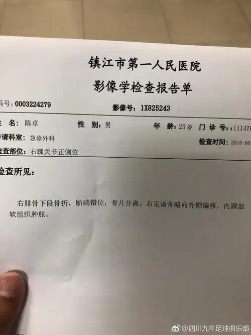 四川九牛队员腓骨骨折,已返回成都进行手术