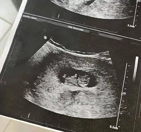 38岁女星钟嘉欣官宣三胎穿紧身衣小腹隆起明显晒三胎b超照