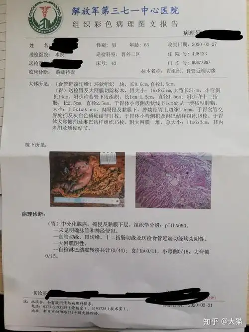 胃癌治疗过程记录