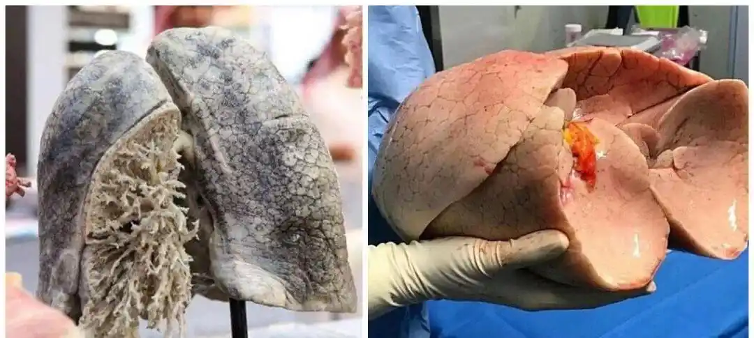 二手烟是如何残害儿童的看完请掐灭世上所有的烟