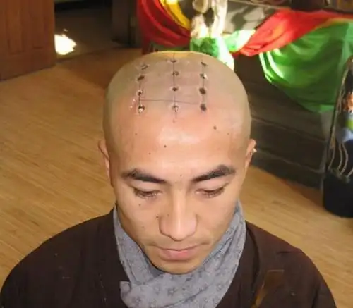 和尚"头顶的圆点",到底有什么用?看完只有心疼的份