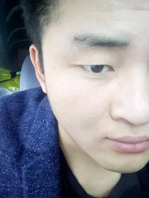眉毛上有一个旋,很尴尬的.