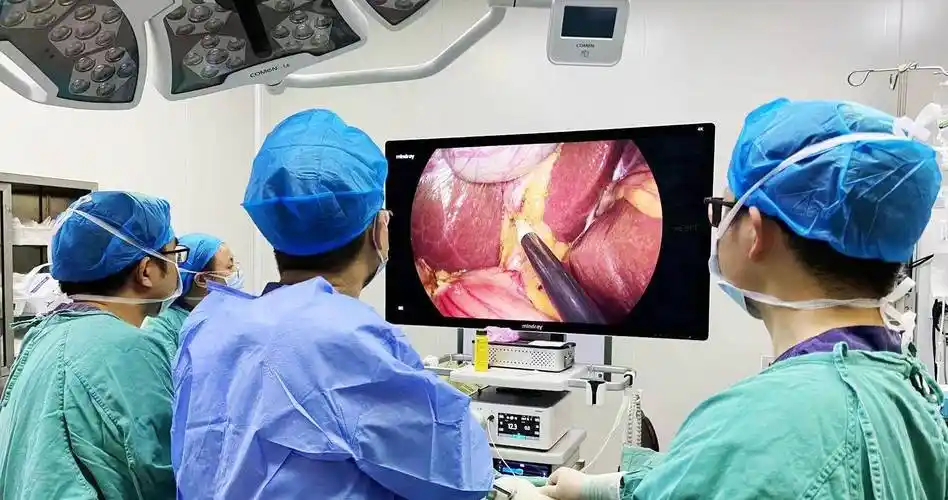 手术开"一孔"愈后无痕-郫都区首例单孔腹腔镜胆囊切除术成功_小美