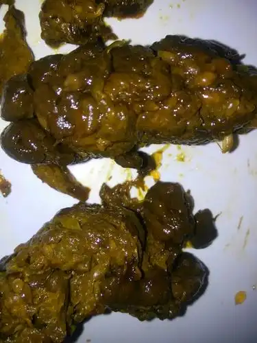 这样大便正常吗