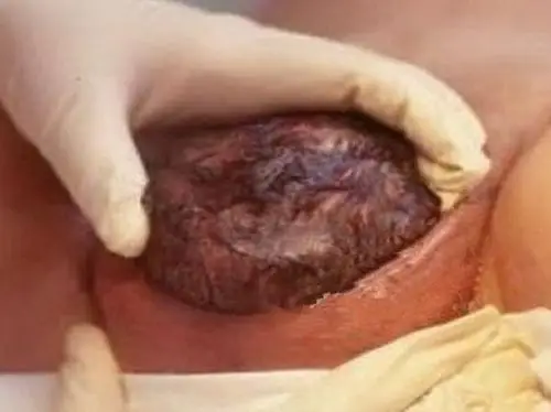 顺产哪家医院好