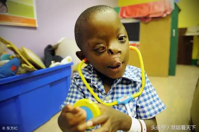 宝宝一不小心成了畸形儿,跟妈妈怀孕的时候这些行为有很大关系!