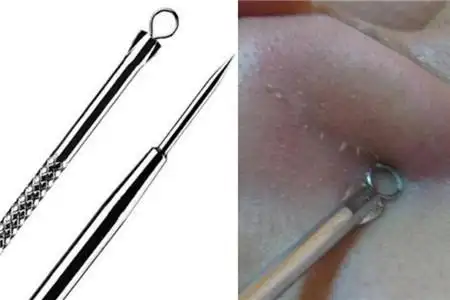 详细分析粉刺黑头针怎么用 如何正确使用护肤工具