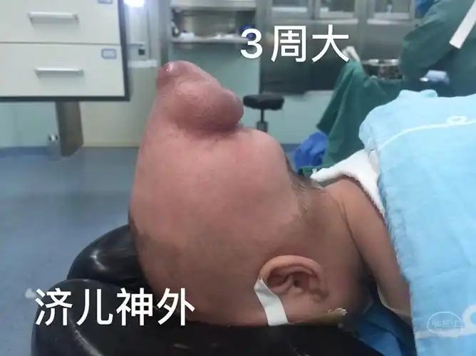 top55月小儿神外病例文章精彩展示