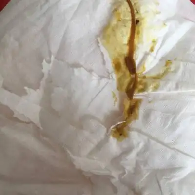 大便完,擦出来白色的长条状肉肉的东西,有两次了,最