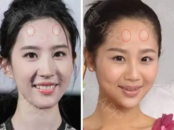 其实有很多人觉得自己额头可能太窄或太短,正面显得不_圈子-新氧美容