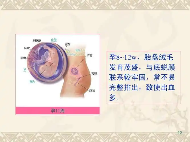 流产课件讲课用ppt