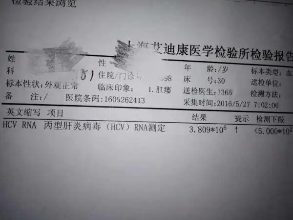 丙型肝炎病毒rna测定数值高!帮忙看一下