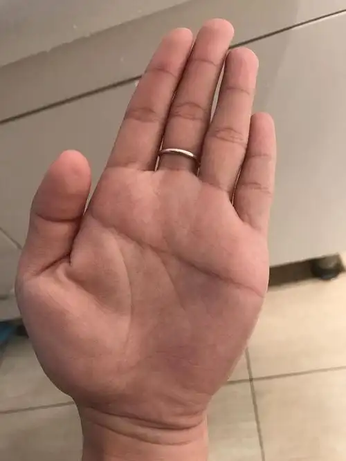 断掌是什么样的图片 断掌是什么样子的图片