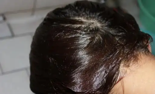 头发一天不洗就很油多油可能是油性发质