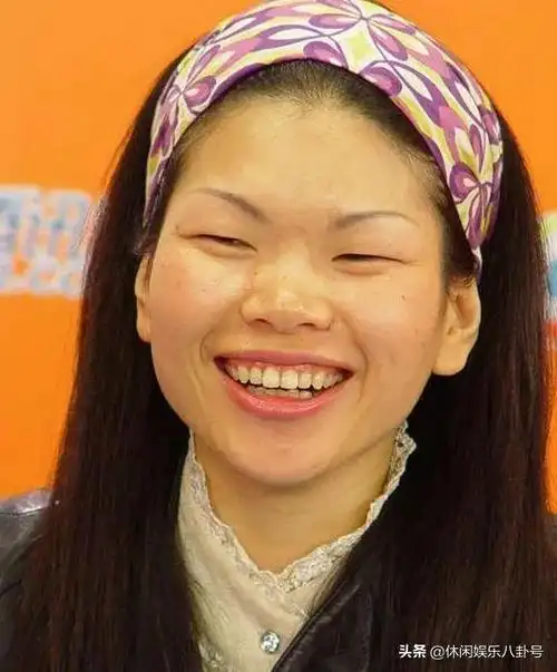 震惊娱乐圈的最丑"女星"们,吕燕远远排不上第一