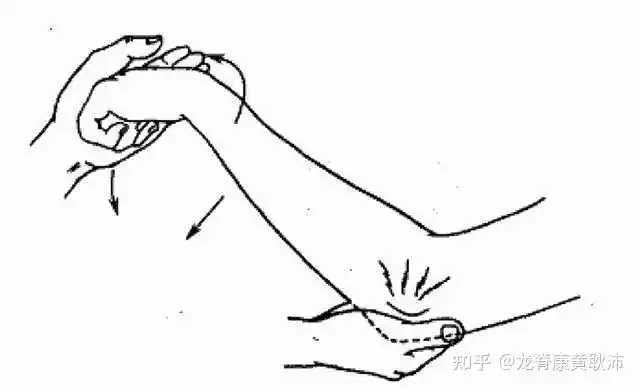 mills征:伸肌腱牵拉试验,伸肘