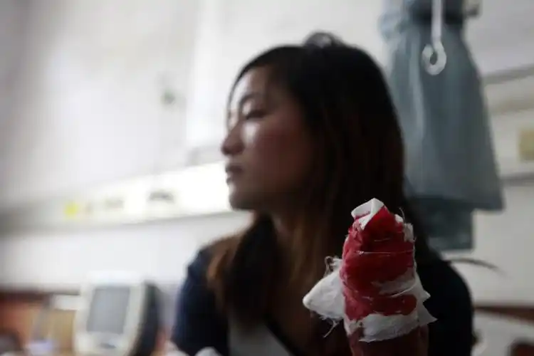 女子乱丢垃圾被环卫工砍断手指 老公手臂臀部被砍