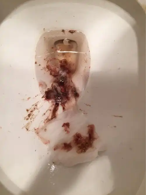 各位宝妈帮我看一下我吐的这是什么,这两天好难受!