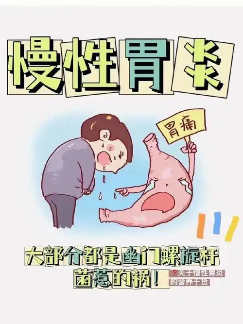 【关于慢性胃炎】676005