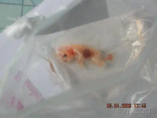 来看看3个月大的胎儿真实图片