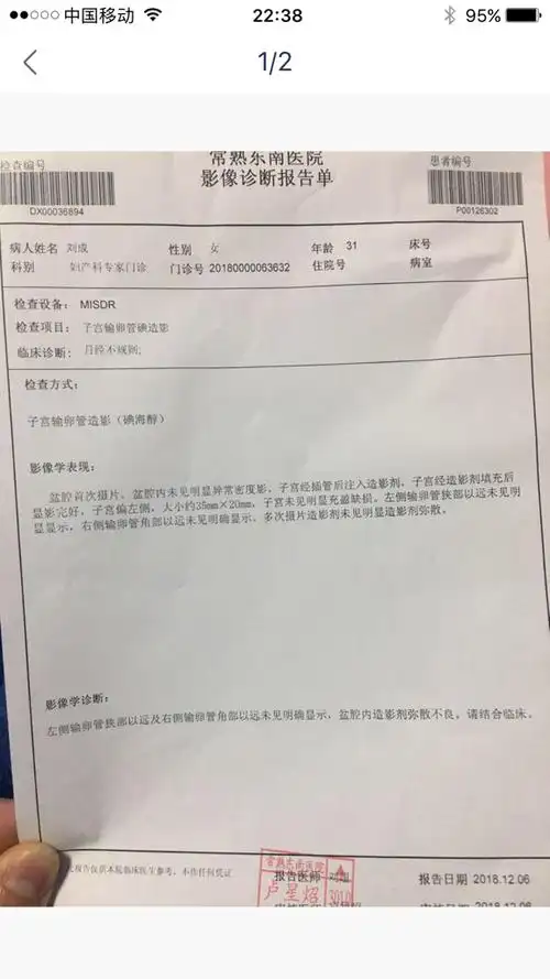 输卵管造影