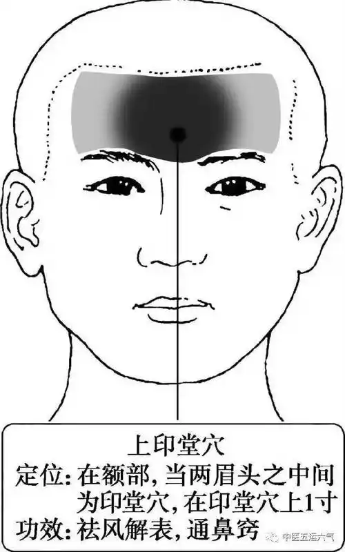 【热敏灸◎临证举隅】过敏性鼻炎