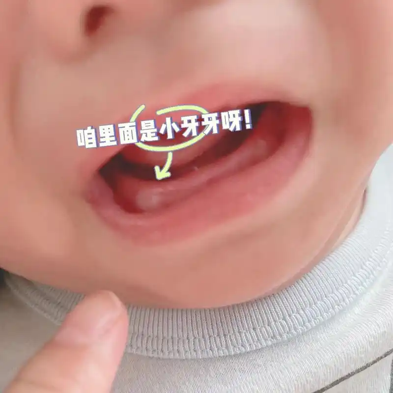 宝宝牙龈外这个小包是什么?