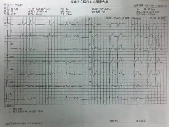 相 关 检 查患者多次来我院就诊,反复多次动态心电图显示提示多发性房