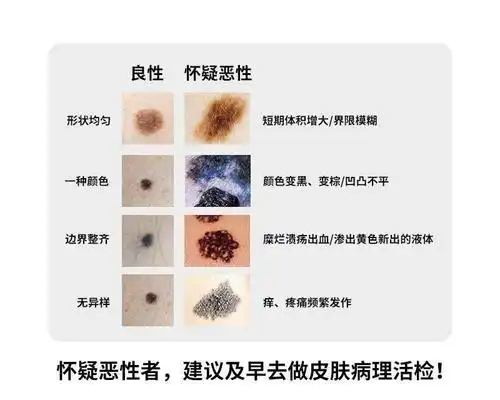 女孩校园卖花救患癌母亲而自己患有恶性黑色素瘤抗癌7年