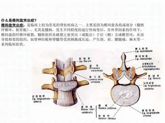 最新 椎间孔镜手术技术 课件