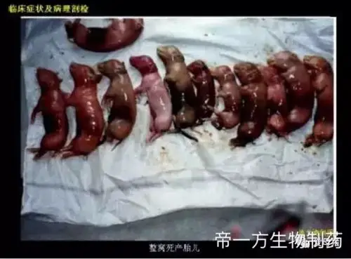 通过"死胎"形状鉴别诊断死亡原因