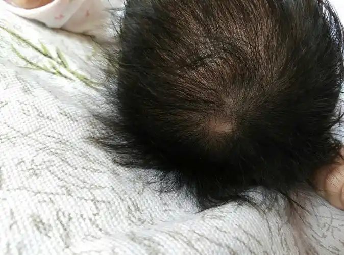 6506个麻麻已点赞 展开阅读全文 最佳回复hot 备孕1楼 精华 是胎记