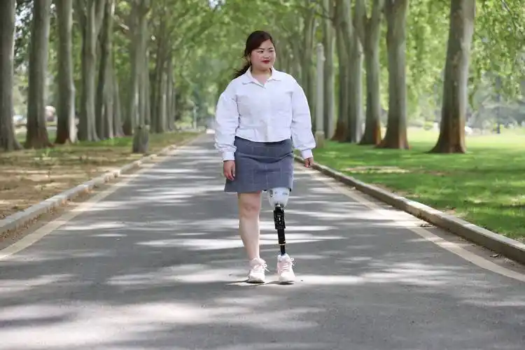 装配假肢后,截肢者往往诉有轻微疼痛,若无特殊情况,这种疼痛会随着