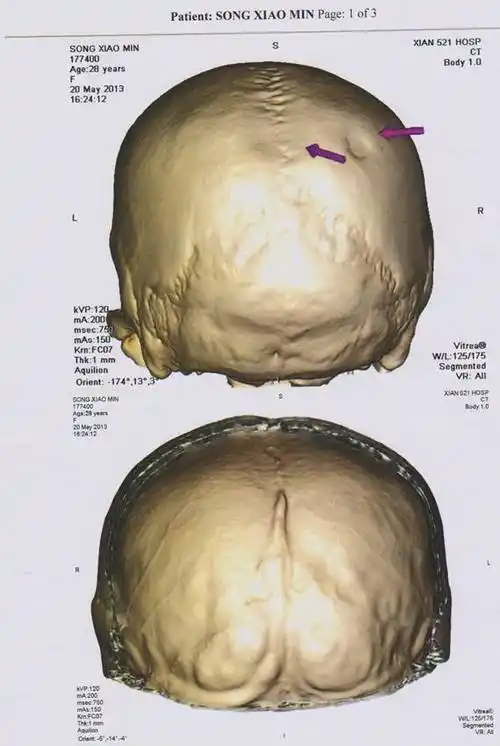潘麟先生什么是皇冠瑜伽