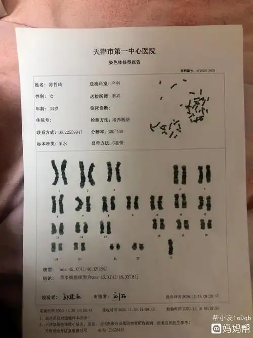 孕健康!成都羊水穿刺费用"如何备孕"-第1张图片-昆途网