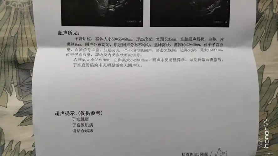 子宫腺肌症ca125已达2495有没有好的医生推荐啊