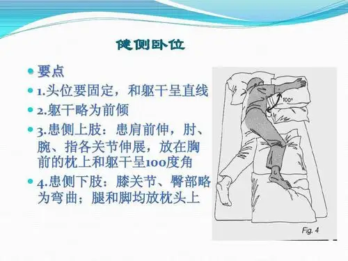 二院康复科---偏瘫患者的良肢位摆放
