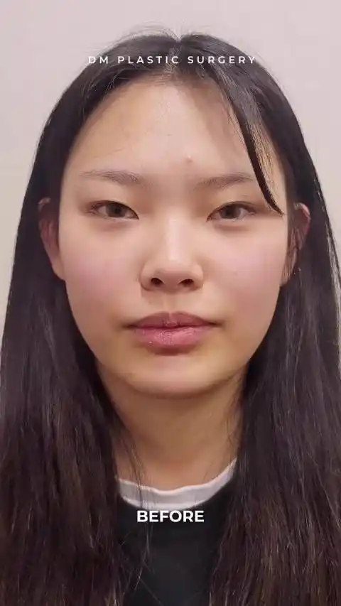 小眼睛,眼尾上扬,塌鼻 短鼻,面平女孩儿,在dm迪美的逆袭!