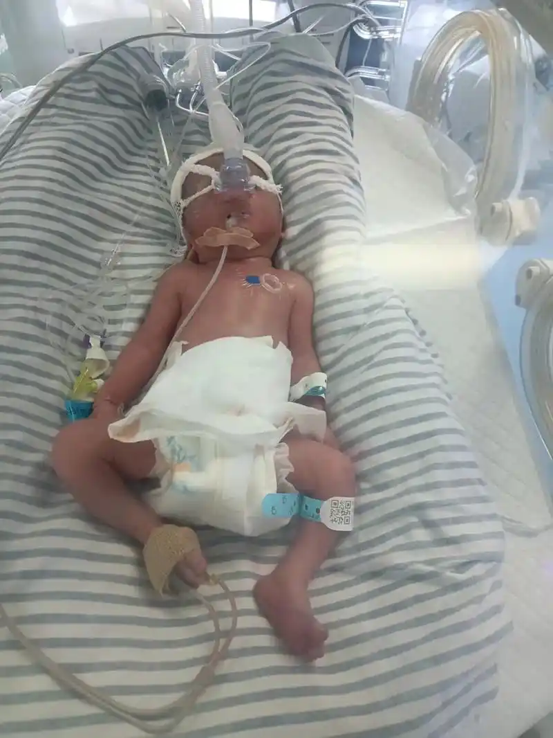 宝宝本来你兔宝宝,结果因为病毒感染早产7个半月出生变了虎宝宝 - 抖