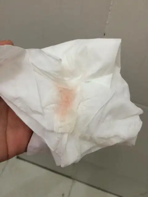 这是什么出血?来月经了还是着床?