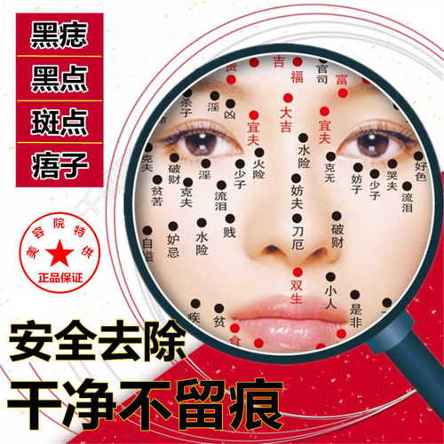 去印祛痣膏凸痣黑色素修复膏点斑水黑点斑点去痦子祛痣点痣药水