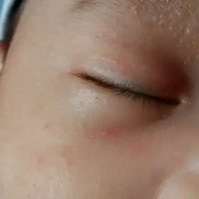 宝宝眼皮有点黑,这两天没怎麼睡好觉.