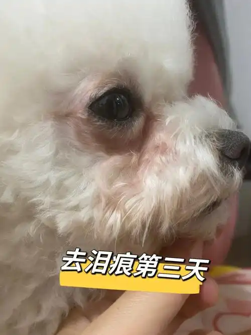 打卡去泪痕第三天