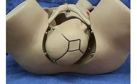 枕后位包括直接枕后op,左枕后lop和右枕后rop,这些胎位由骨盆内部构造